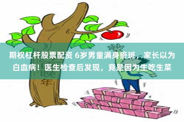期权杠杆股票配资 6岁男童满身瘀斑，家长以为白血病！医生检查后发现，竟是因为生吃生菜