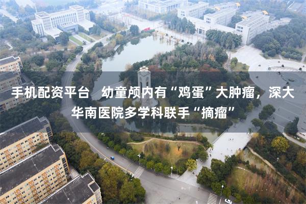 手机配资平台   幼童颅内有“鸡蛋”大肿瘤，深大华南医院多学科联手“摘瘤”